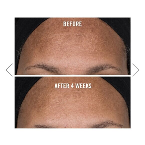 First Aid Beauty FAB Dark Spot Serum Facial Radiance Niacinamide 1.0 oz NEW - Picture 6 of 6